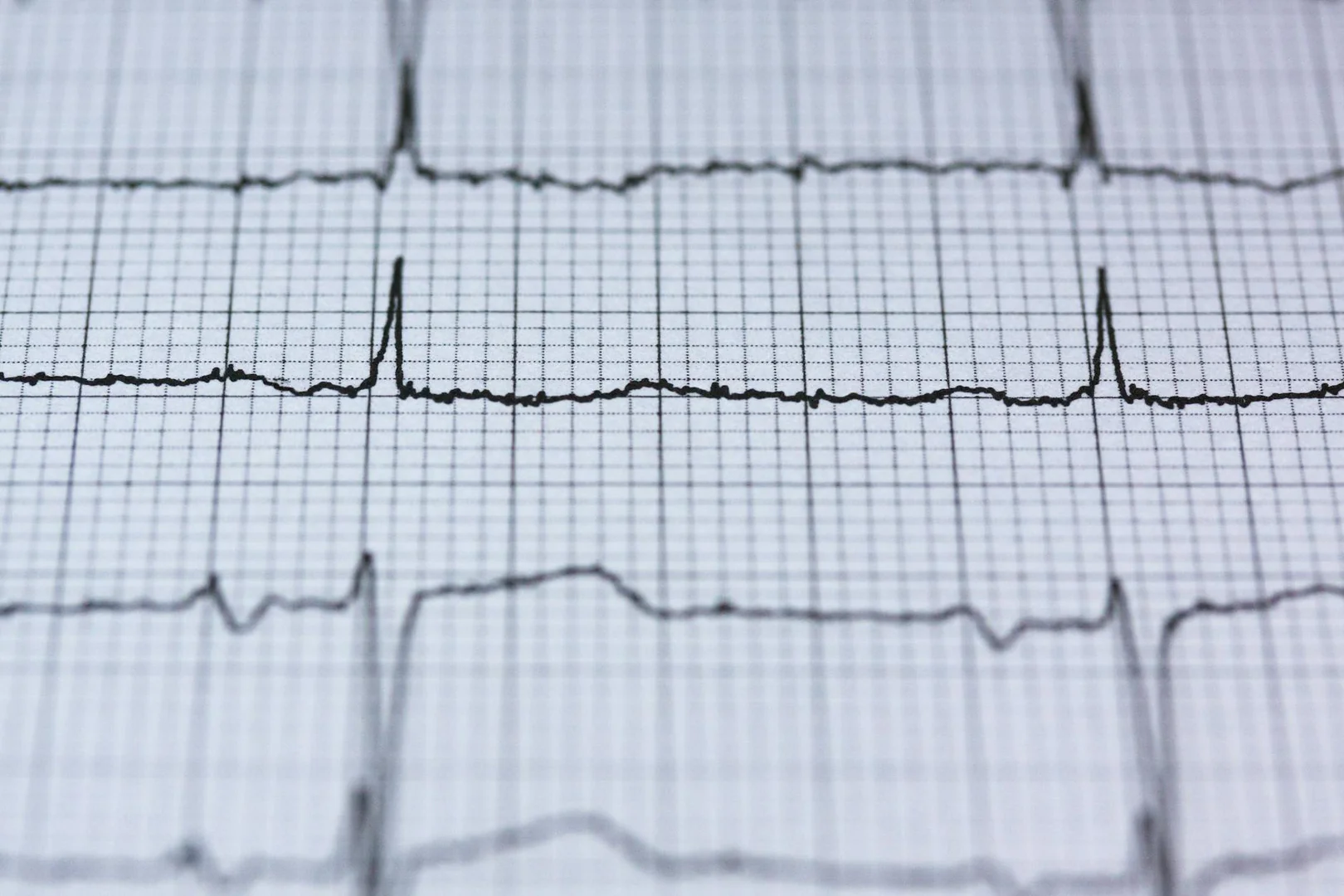 LLM as Clinical Graph Structure Refiner: Enhancing Representation Learning in EEG Seizure Diagnosis